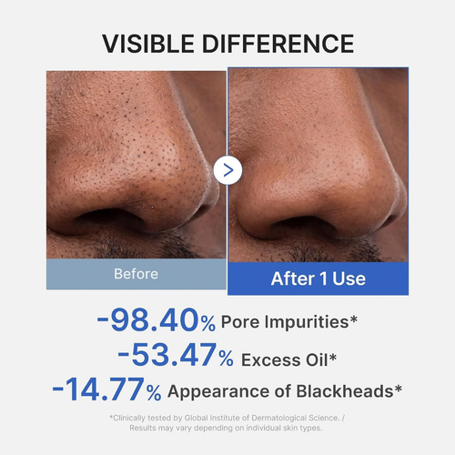 Zero Pore Blackhead Mud Wrapping Mask