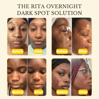 Kojic Acid Turmeric Night Wrapping Mask