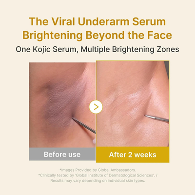 Kojic Acid Turmeric Niacinamide Serum