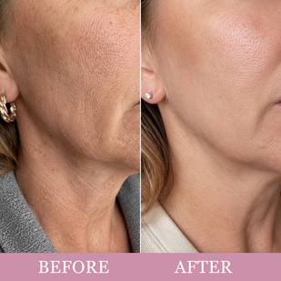 PROVEN RESULTS, NOT JUST PROMISES