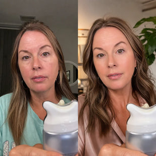 WORKS LIKE A TOPICAL NECK LIFT